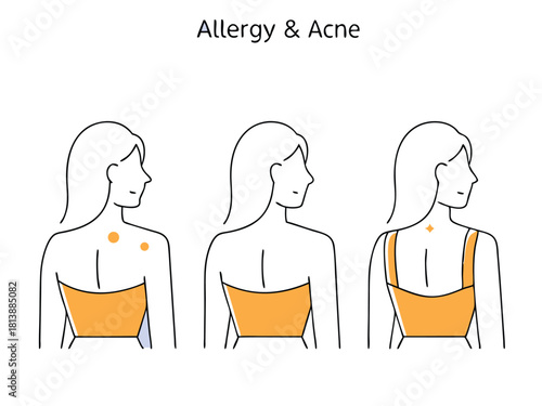 Illustrated depiction of skin conditions including allergies and acne with women silhouettes on a transparent background.