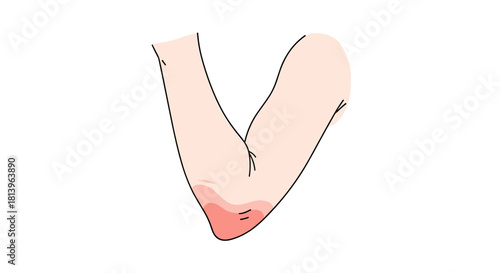 Red and irritated elbow close-up illustration in minimal design  