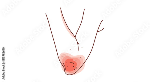 Rough elbow with redness indicating skin irritation  