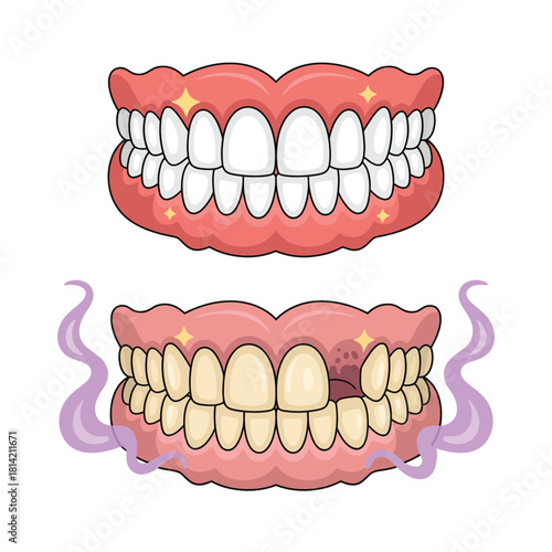 Comparison of healthy teeth and dentures with missing teeth and bad breath