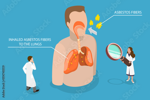 3D Isometric Flat Vector Illustration of Asbestos, Symptoms Of Asbestos Exposure, Chest Pain, Swollen Testes, And Scrotum, Fluid In Chest