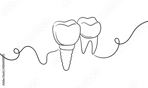 2 Teeth set continious line drawing. Dentistry, caries, filling, implant outline. Vector illustration. 