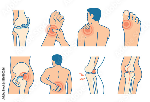 Diagram illustrating common joint pain areas in human body with highlighted regions