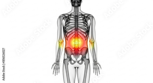 Illustration of a human skeleton with highlighted lower back and arm joints indicating pain and inflammation