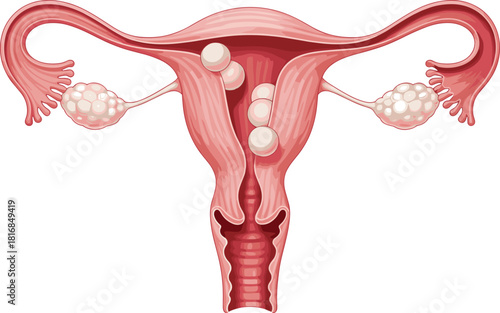 Female reproductive system illustration showing uterus, ovaries, fallopian tubes, cervical canal, medical anatomy diagram with fertilization path details and scientific educational vector graphics.