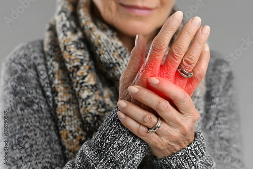 Close-up of an elderly woman’s hands with one hand gripping the other in pain, showing red inflammation, possibly due to arthritis or joint pain.
