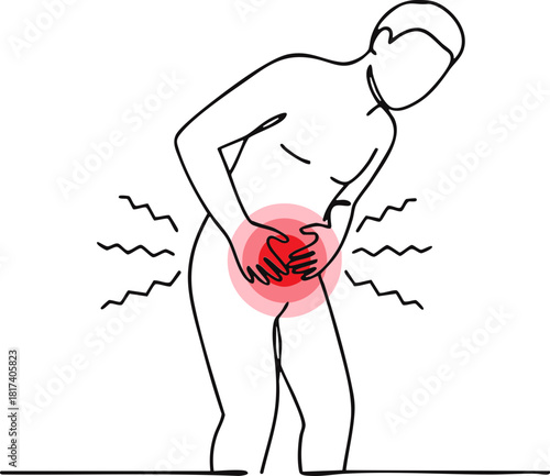 Line art of a stylized male figure holding his lower abdomen experiencing prostate pain, Line art of a stylized male figure holding his lower abdomen prostate pain. Ailment includes prostate pain,