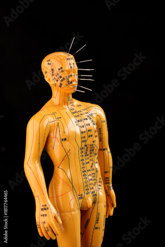 Chinese Acupuncture Model with Meridian Points and Needles Traditional Medicine Educational Display