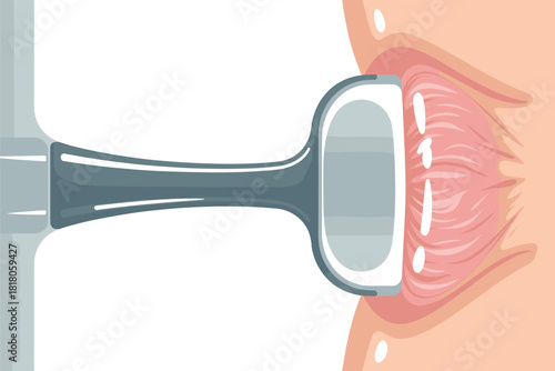 Vaginal Ultrasound Procedure: Illustration of Ultrasound Probe, Vaginal Anatomy, and Musculature in a Medical Setting for Health and Diagnostics