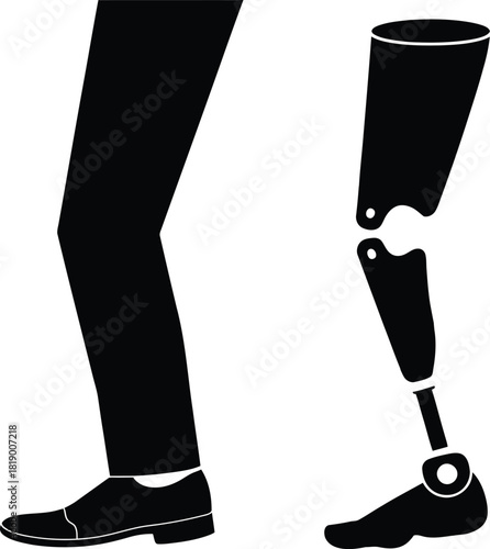 Human leg and prosthetic limb side by side. rehabilitation.