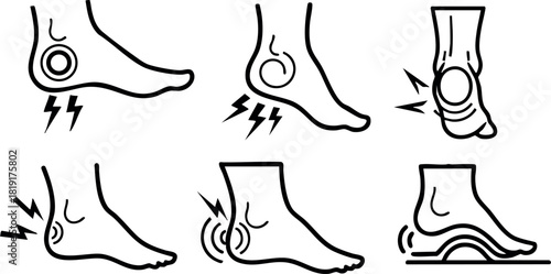 Foot pain anatomy illustration showing common heel and arch pain symptoms vector illustration