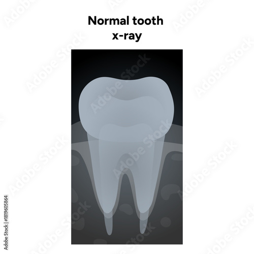 Hand-drawn dental infographic of healthy tooth X-ray, internal anatomy enamel, dentin, pulp, and roots. Educational illustration ideal for dental clinics, oral hygiene 