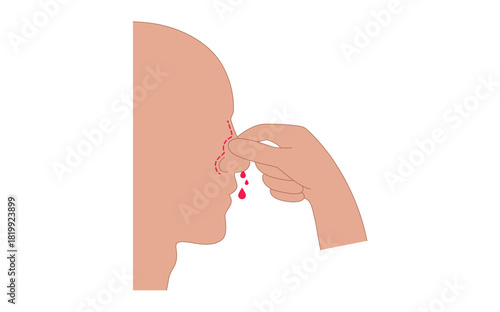 Stop nosebleed instruction