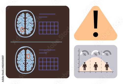 Brain scans with highlighted regions, risk alert symbol, and statistical data graph depicting population risk distribution. Ideal for healthcare, analysis, research, medicine, neurology, technology