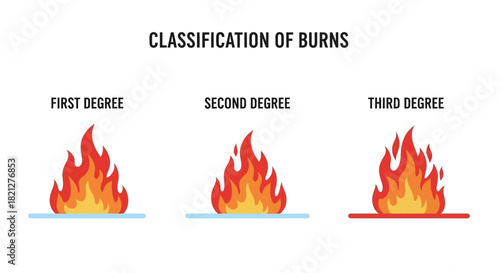 Showing the classification burns first degree, second degree, and third degree, with visual representation flames