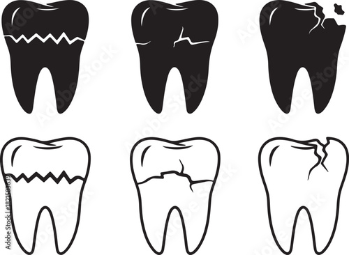 Six illustrations of teeth depicting different stages of dental health, including healthy, cracked, and decayed