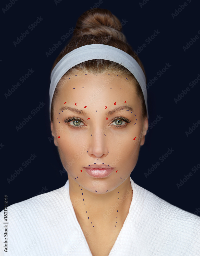 Fototapeta Botulinum toxin injection for facial wrinkles  ,in the therapy of mimic facial lines