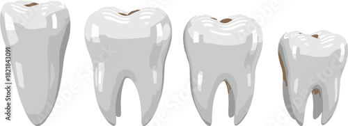 Human teeth anatomy vector illustration, incisor, canine, premolar, molar, dental chart, oral health, educational poster, simplified tooth types, medical reference