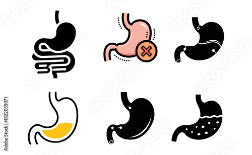 Human stomach showing different conditions and health issues in a medical diagram, highlighting digestive problems and potential diseases.