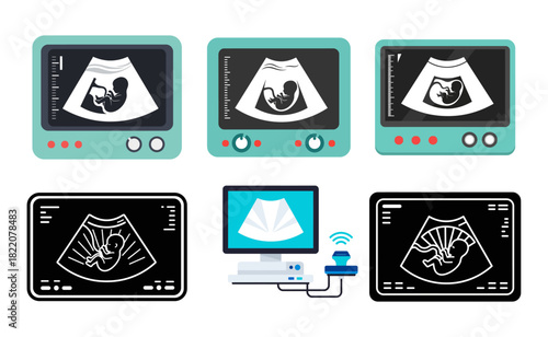 Ultrasound machines display fetal images during prenatal checkups in a medical clinic, showcasing modern healthcare technology and expectant parenting.