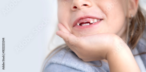 happy positive funny toothless 6-year-old girl, Close-up smiling child's face, showcasing missing baby teeth and joyful expression, waiting for toothfairy, innocence, growth, and childhood milestones
