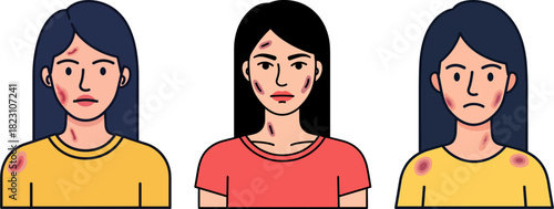 Three women expressing different emotions, showing skin imperfections, on a transparent background, depicting feelings of sadness, frustration, and concern in vibrant colors.