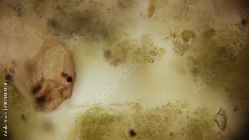Microscopic Creature Eating Algae