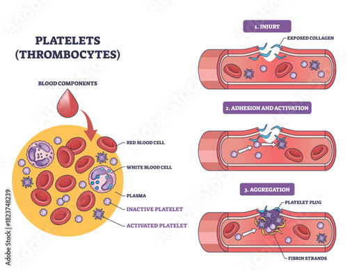 Platelets thrombocytes visual shows vessel injury, adhesion and aggregation forming a platelet plug, key objects, platelets, red blood cells, fibrin strands. Outline diagram