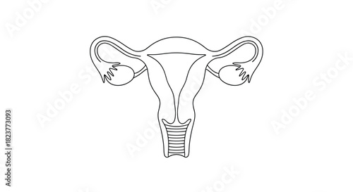 Detailed line art illustration of a female reproductive system, including the uterus, fallopian tubes, and cervix, isolated on a white background.