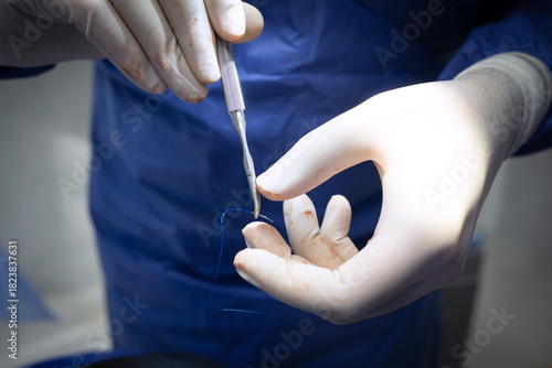 The doctor is holding a medical needle and surgical instruments, suturing a patient's wound in the operating room.