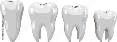 Human teeth anatomy vector illustration, incisor, canine, premolar, molar, dental chart, oral health, educational poster, simplified tooth types, medical reference