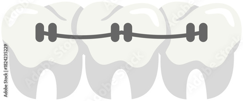 Dental Braces Illustration Editable Color Vector