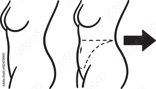 Illustration of Body Contouring and Fat Reduction Procedures