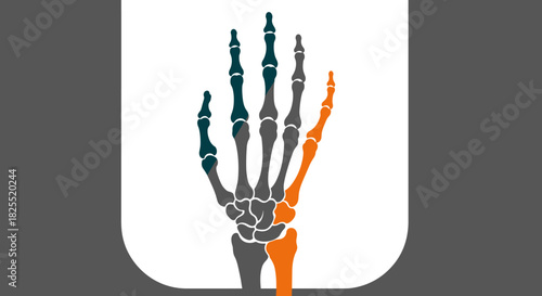 Illustration of a hand skeleton showing the bones in different colors isolated on white background for medical or educational purposes and presentations