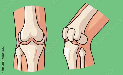 Anatomical illustration of the human knee joint from anterior and lateral views, showing bones and cartilage.