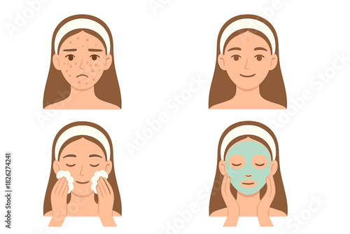 Skincare routine steps for acne treatment showing before and after results with cleansing and mask