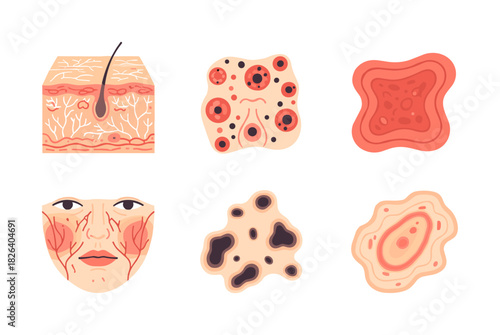 Human skin problems and diseases dermatology illustration