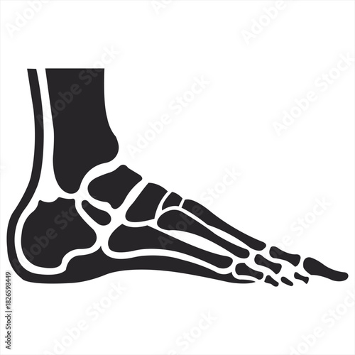 Illustration of a human foot skeleton in black and white showing bones and anatomical structure clearly