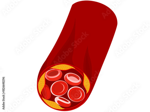 Fat in the arteries causes disease in the human body.