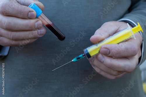 In the man's hands is a syringe and a test tube with collected blood.