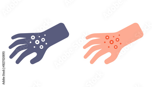Red rash on hand icon. Flat illustration.