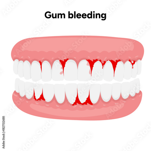 Hand-drawn illustration of bleeding gums, dental and oral anatomy. Ideal for dental education, medical materials, oral health guides, anatomy learning, and professional dentistry content