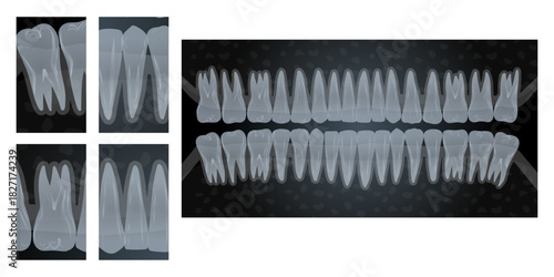 Hand-drawn illustration of all 32 healthy adult teeth with CT scan and X-ray views of multiple teeth, internal anatomy, roots, and jaw alignment. Dental education. Professional dentistry content