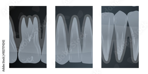 Hand-drawn illustration of X-ray scans of multiple healthy adult teeth, showing detailed tooth structure, roots, and jaw alignment. Dental education. Professional dentistry content