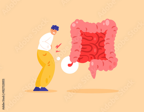 Appendicitis concept. Inflammation of the appendix. Illustration of a man appearing to be experiencing abdominal pain. Intestinal health problems. Flat design style. Orange background.