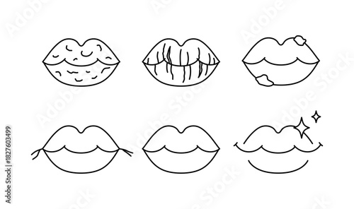 Lip disease icons set. Peeling lips, cracked lips, sores. Line vector, editable stroke