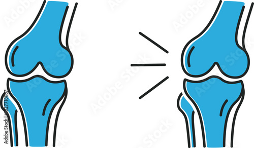 Stylized Blue Knee Joint Illustrations on White Background, Medical Concept Art