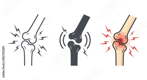 Knee pain vector illustration set isolated on white background collection of knee joint problems, arthritis, inflammation, injury, and discomfort concepts