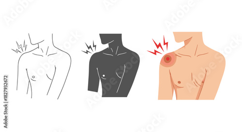 Illustration of shoulder pain with different styles isolated on white background concept of shoulder injury, muscle pain, or joint inflammation medical vector