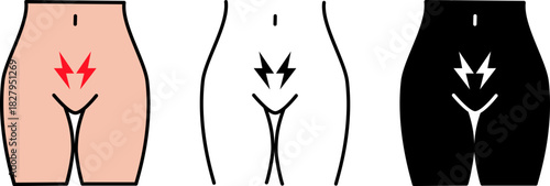 Medical illustration of female pelvic pain, concept of acute discomfort radiating to the lower abdomen and groin, design of symptoms of gynecological or urological conditions